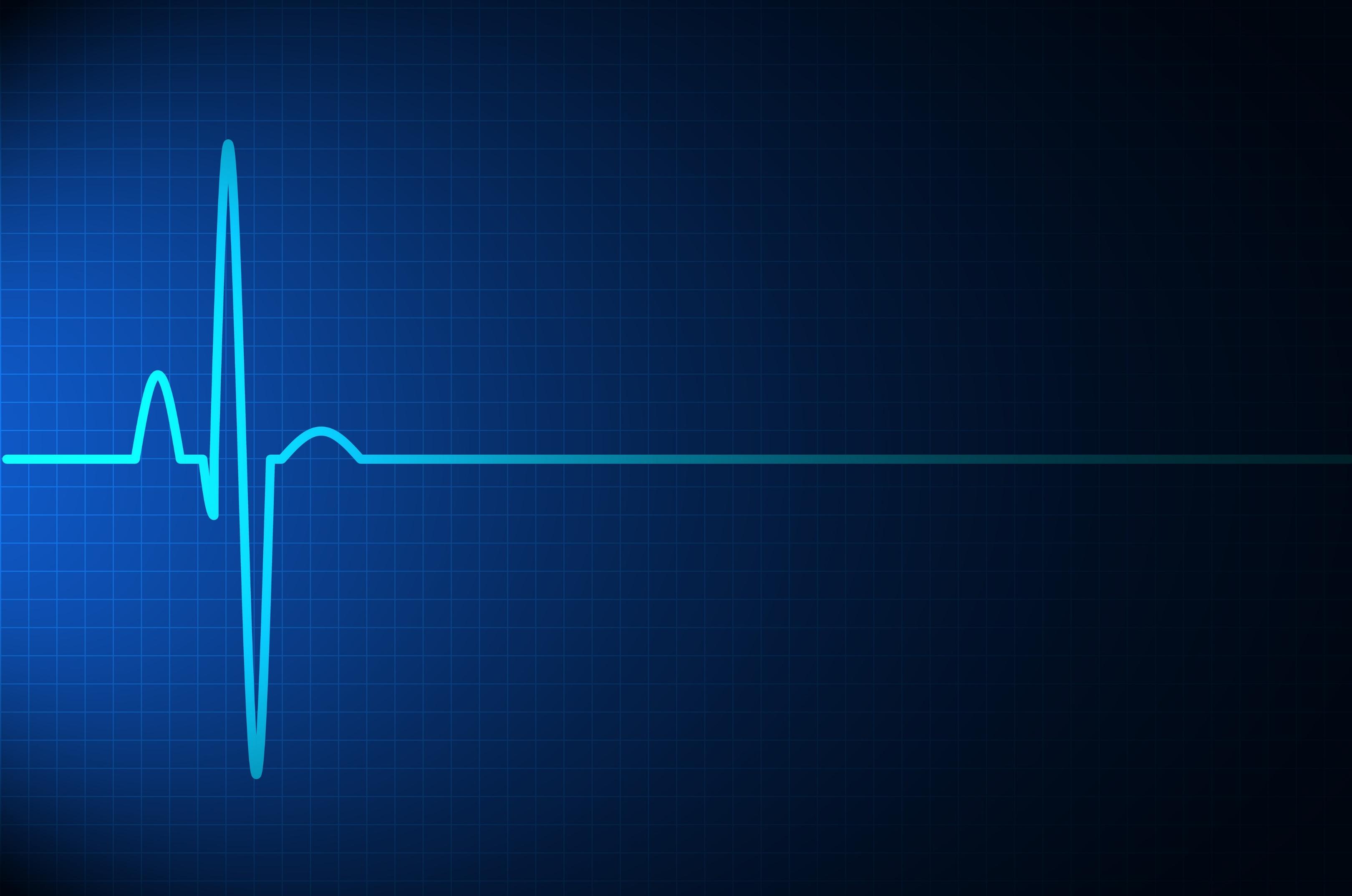 resultat d'un cardiogramme 